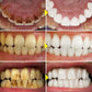 30g Teeth Whitening Powder