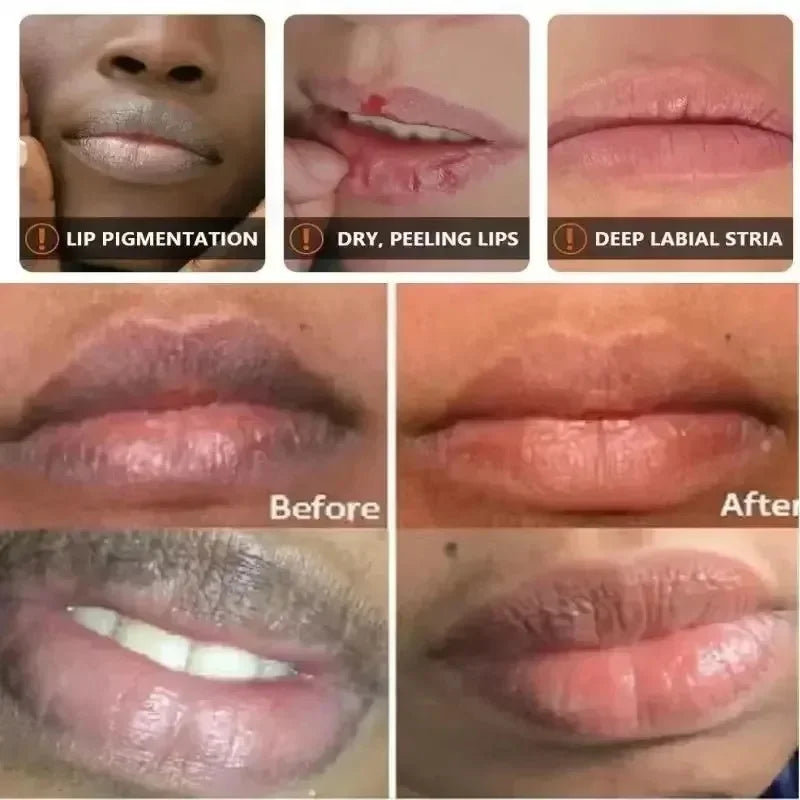 Brightening Exfoliating Lip Treatment