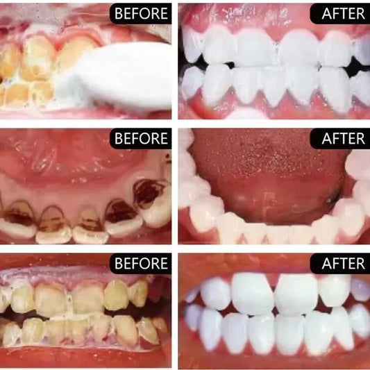 30g Teeth Whitening Powder